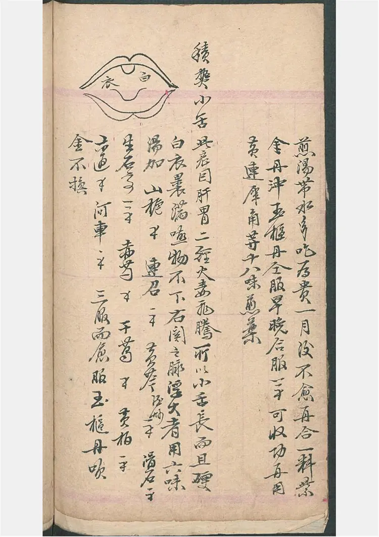 民间喉舌方抄本