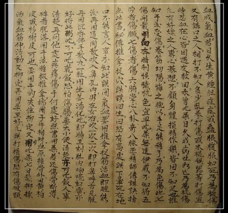 江西高安民间家传穴位伤科跌打书手抄本52页（一切良方）