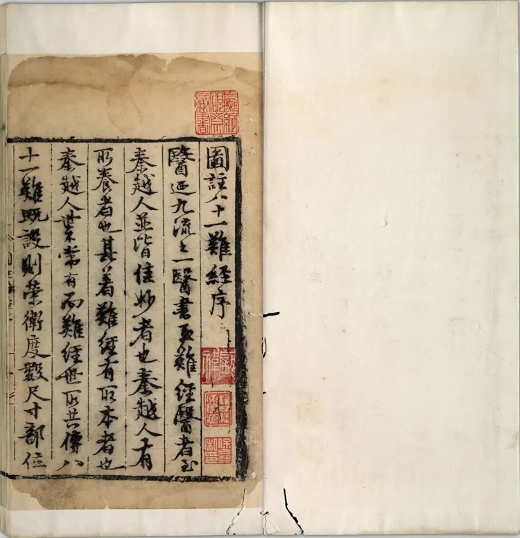 图注八十一难经.八卷.明.张世贤撰.明正德五年扬州吕邦佑刊本 图注八十一难经.八卷.明.张世贤撰.明正德五年扬州吕邦佑刊本