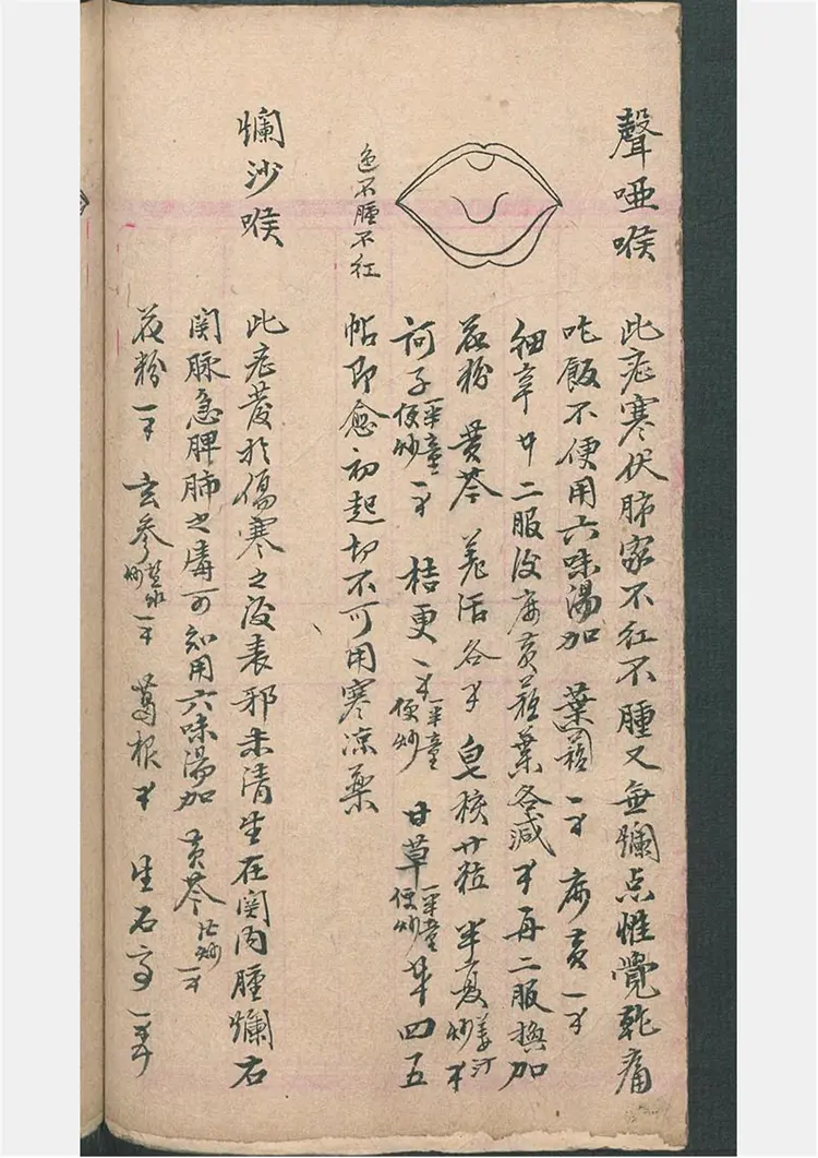 民间喉舌方抄本