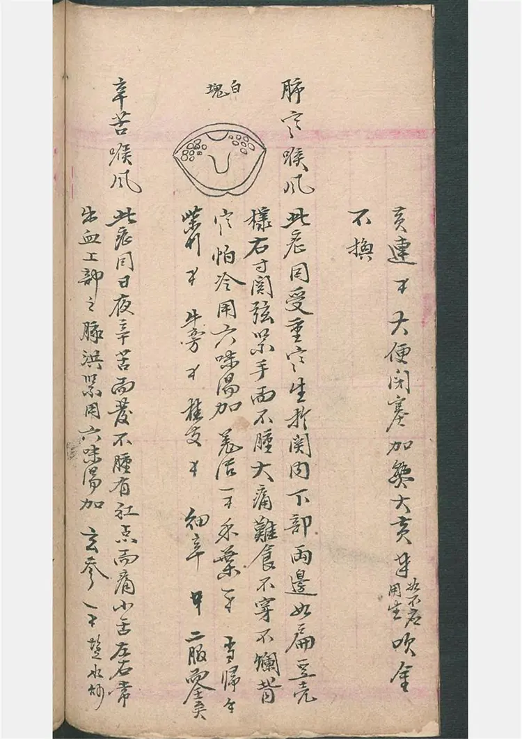 民间喉舌方抄本