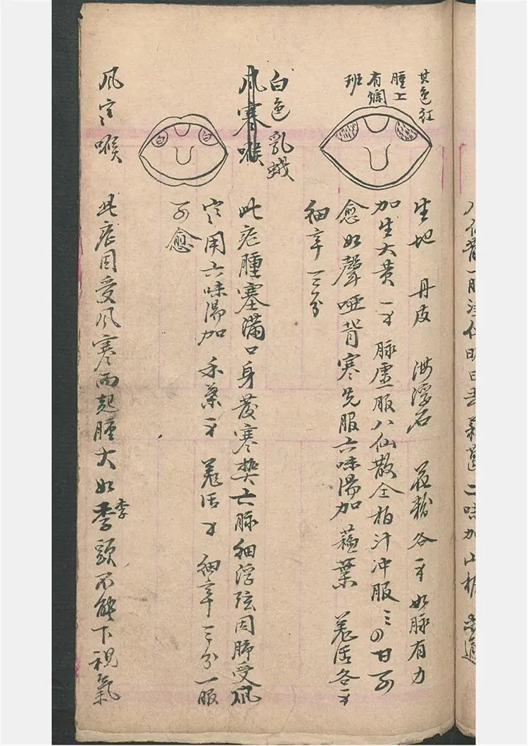 民间喉舌方抄本