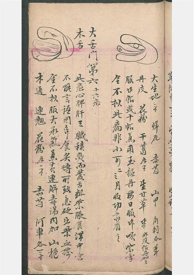 民间喉舌方抄本