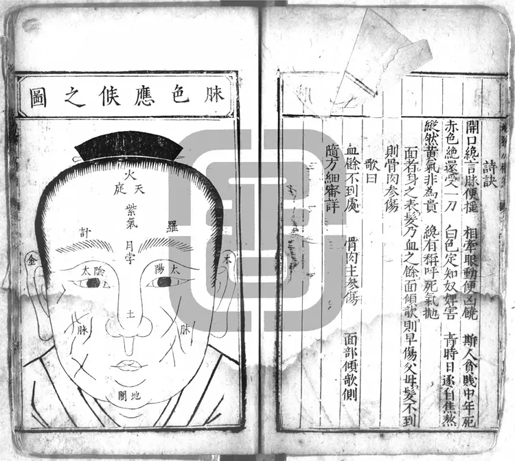 明万历十五年刊本《新刊校正增释合并麻衣先生人相编 》