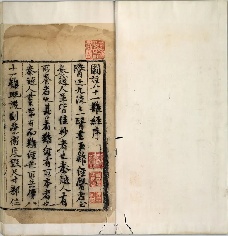 图注八十一难经.八卷.明.张世贤撰.明正德五年扬州吕邦佑刊本